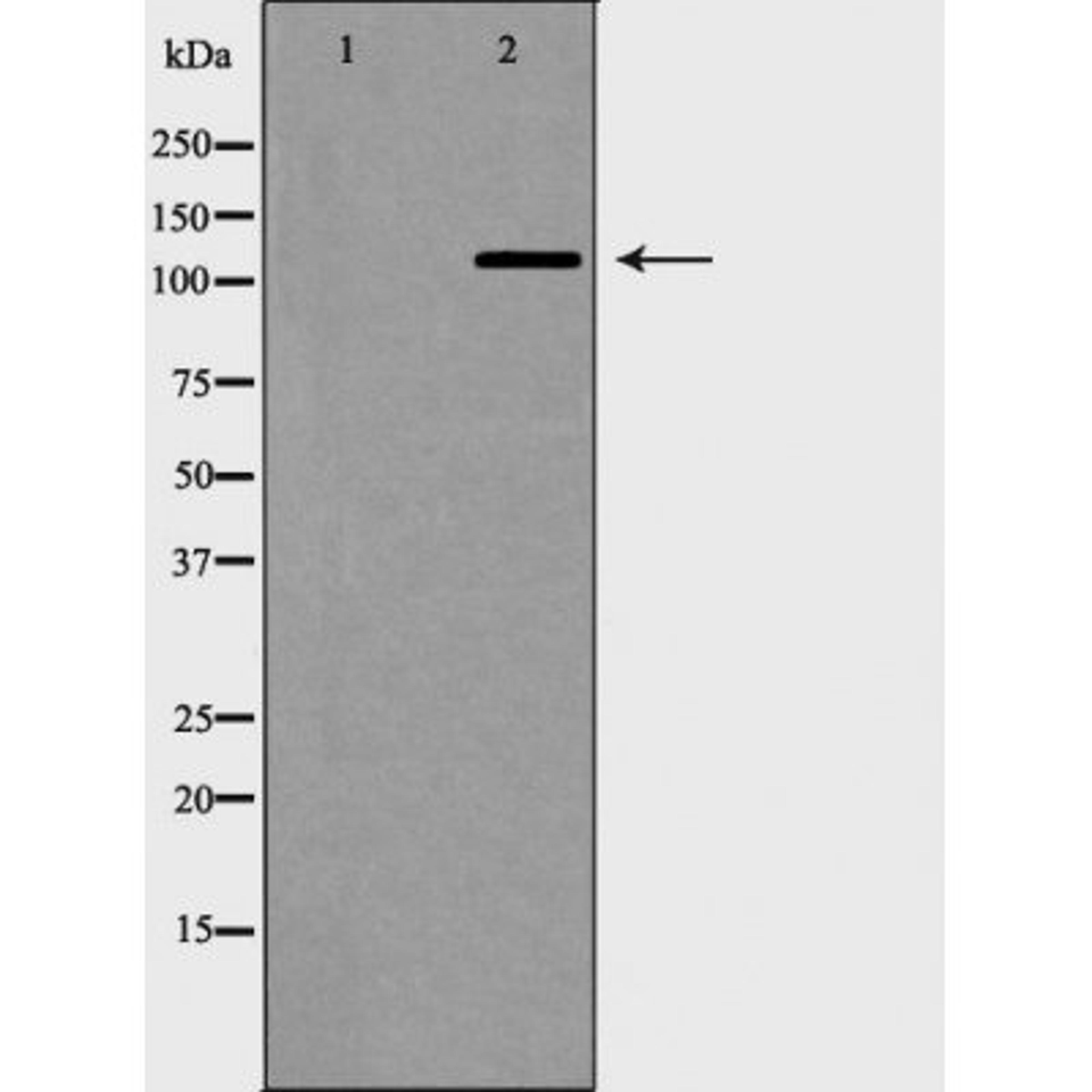 Western blot analysis of Jurkat cells using Telomerase (Phospho-Ser824) antibody