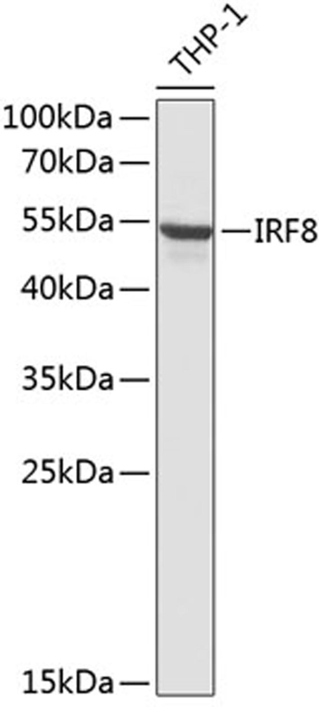 Western blot - IRF8 antibody (A13677)