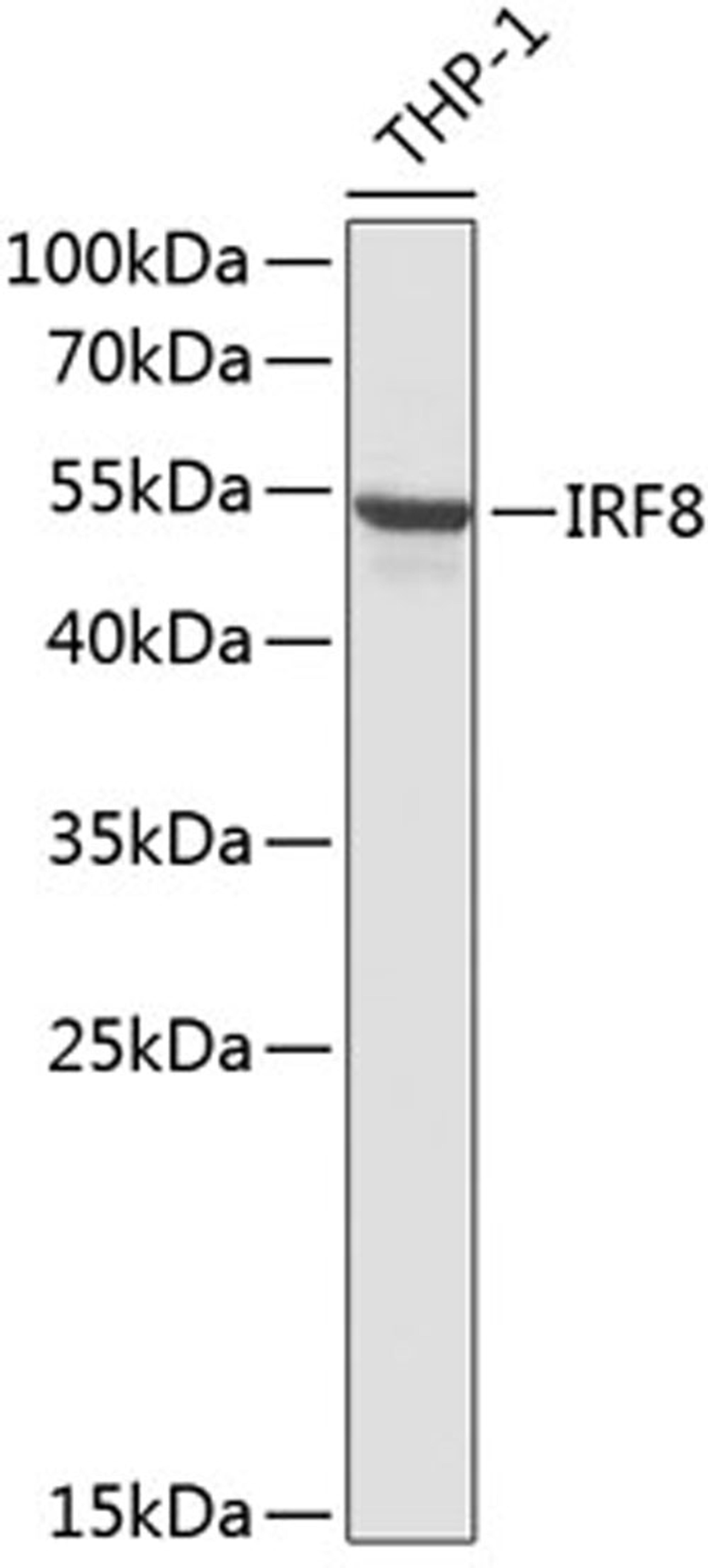 Western blot - IRF8 antibody (A13677)