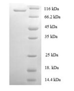 (Tris-Glycine gel) Discontinuous SDS-PAGE (reduced) with 5% enrichment gel and 15% separation gel.