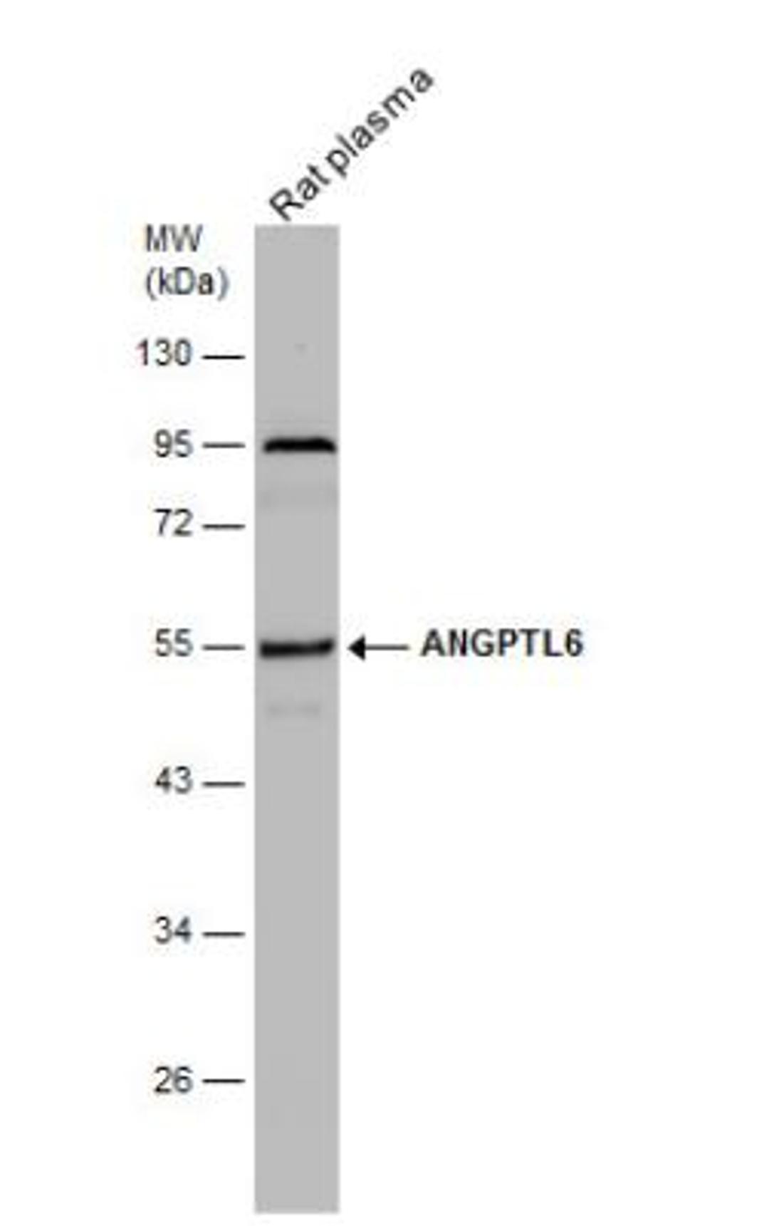 Western Blot: Angiopoietin-like Protein 6/ANGPTL6 Antibody [NBP2-15394] - Rat tissue extract (50 ug) was separated by 10% SDS-PAGE, and the membrane was blotted with ANGPTL6 antibody diluted at 1:1000.