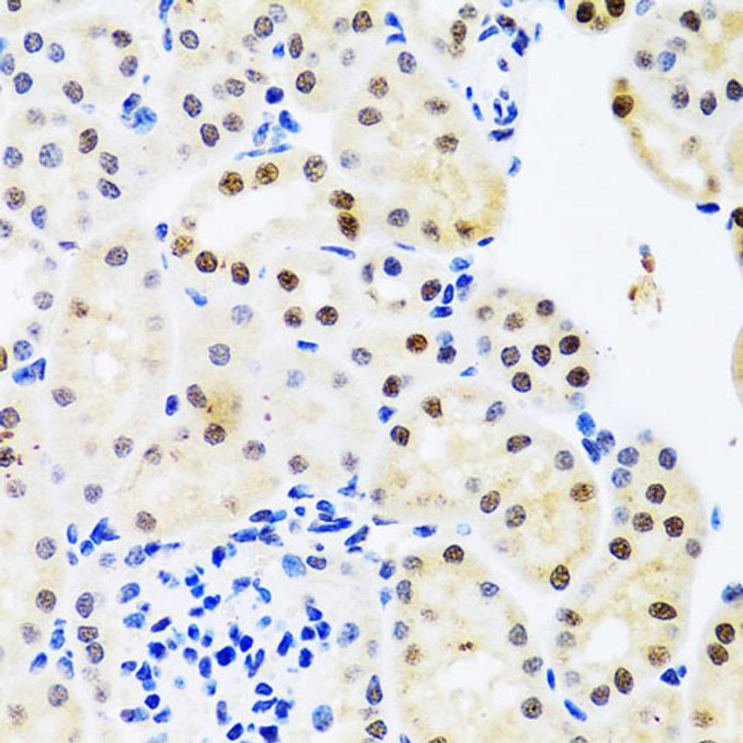 Immunohistochemistry - SET antibody (A6212)