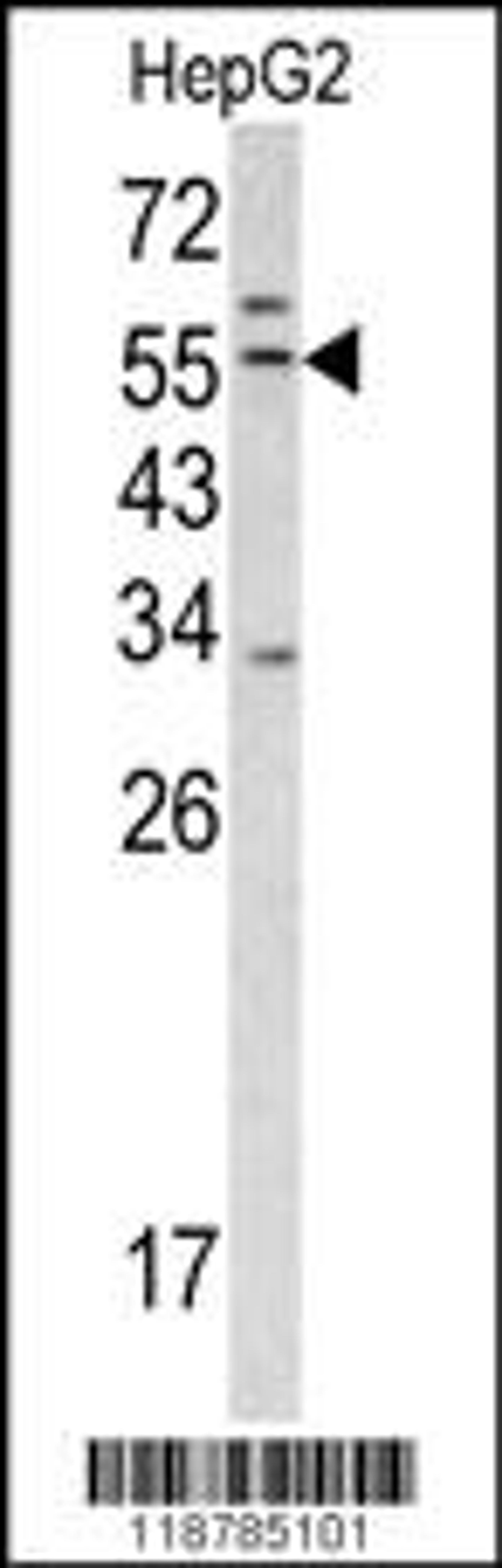 Western blot analysis of TMPRSS2 antibody in HepG2 cell line lysates (35ug/lane)