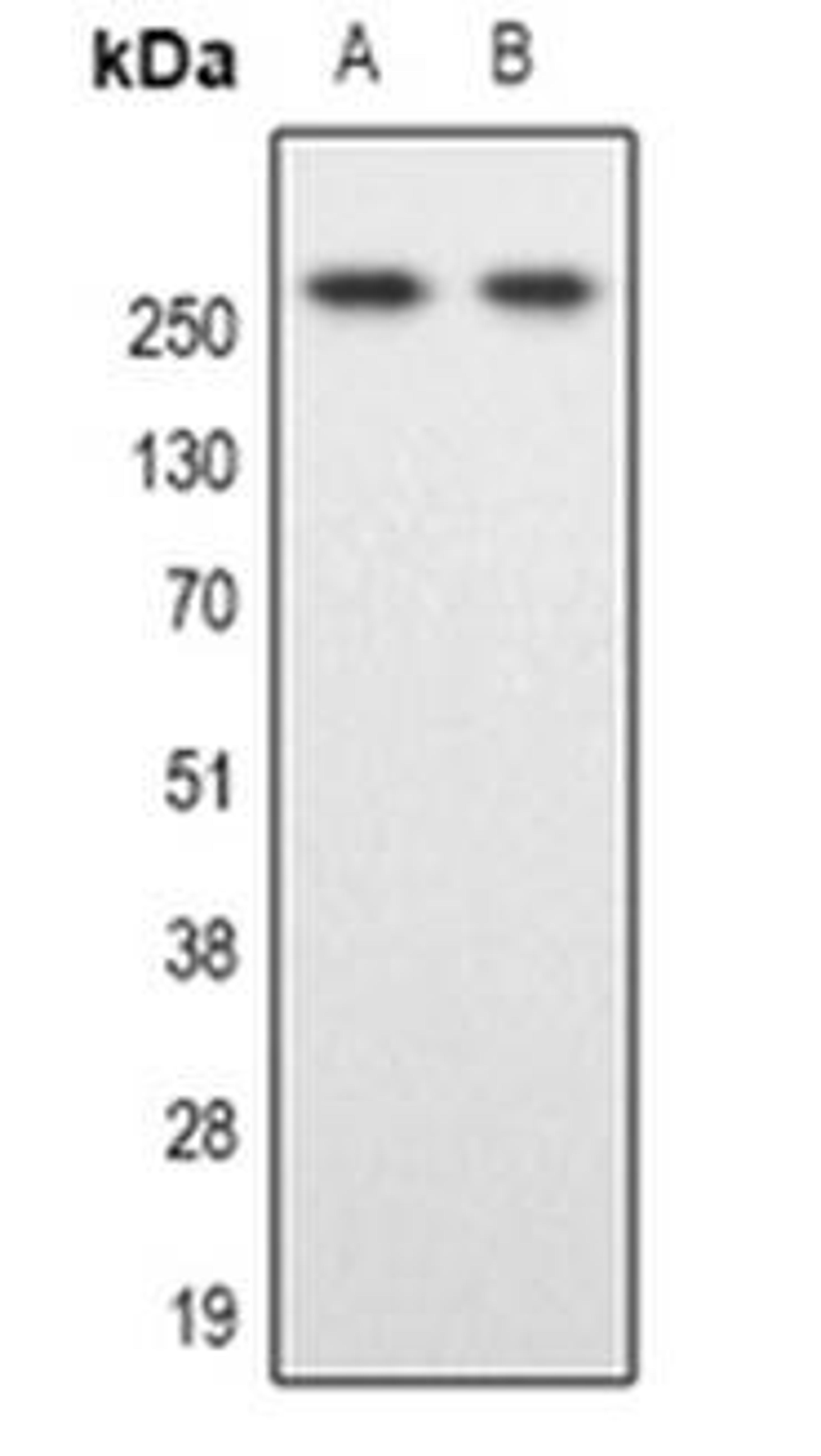 Western blot analysis of SPTBN1 expression in Hela (Lane 1), Colo205 (Lane 2) whole cell lysates using SPTBN1 antibody