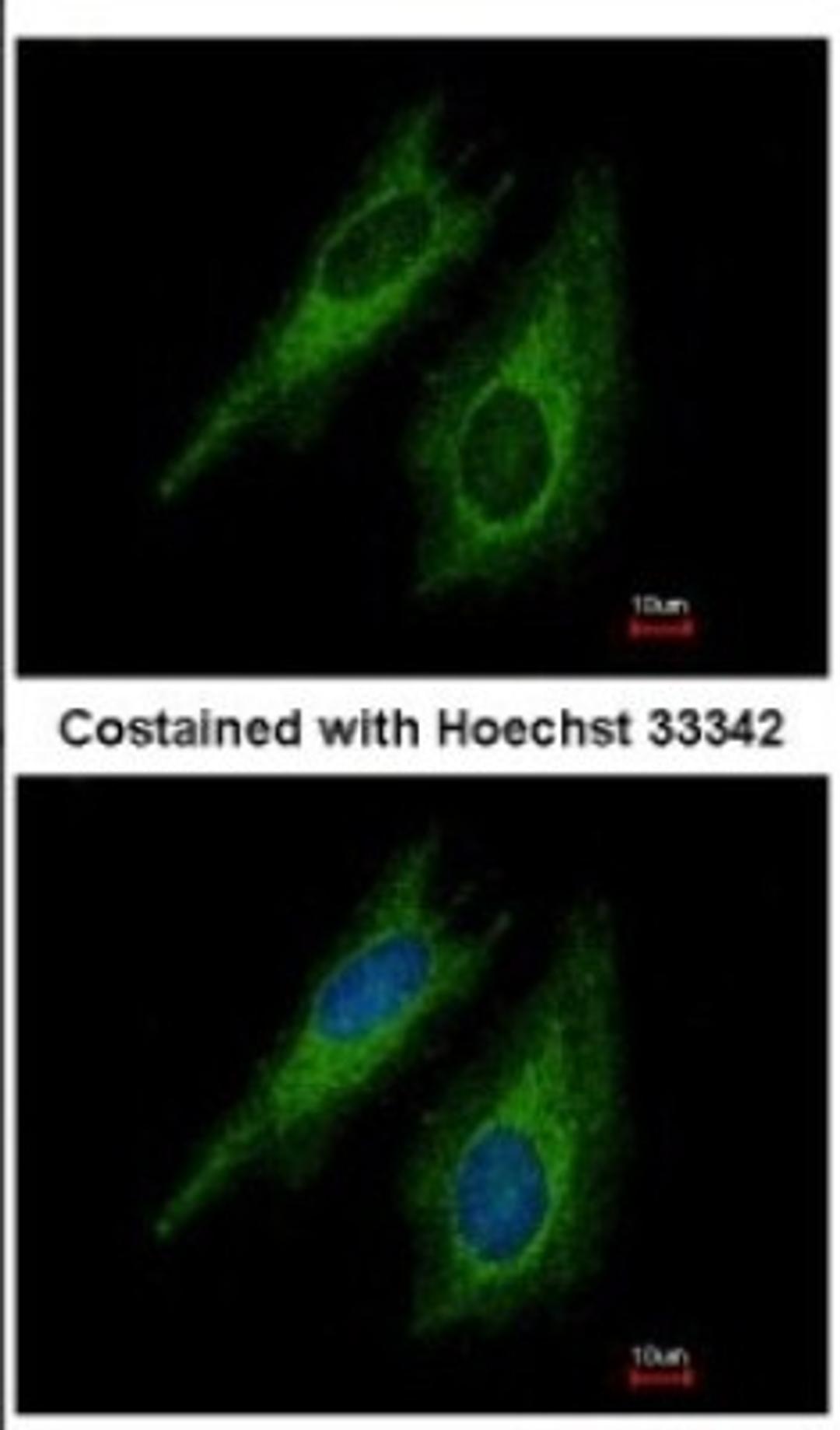 Immunocytochemistry/Immunofluorescence: TGF beta Receptor I Antibody [NBP2-20611] - Immunofluorescence analysis of methanol-fixed HeLa, using antibody at 1:500 dilution.