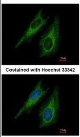 Immunocytochemistry/Immunofluorescence: TGF beta Receptor I Antibody [NBP2-20611] - Immunofluorescence analysis of methanol-fixed HeLa, using antibody at 1:500 dilution.