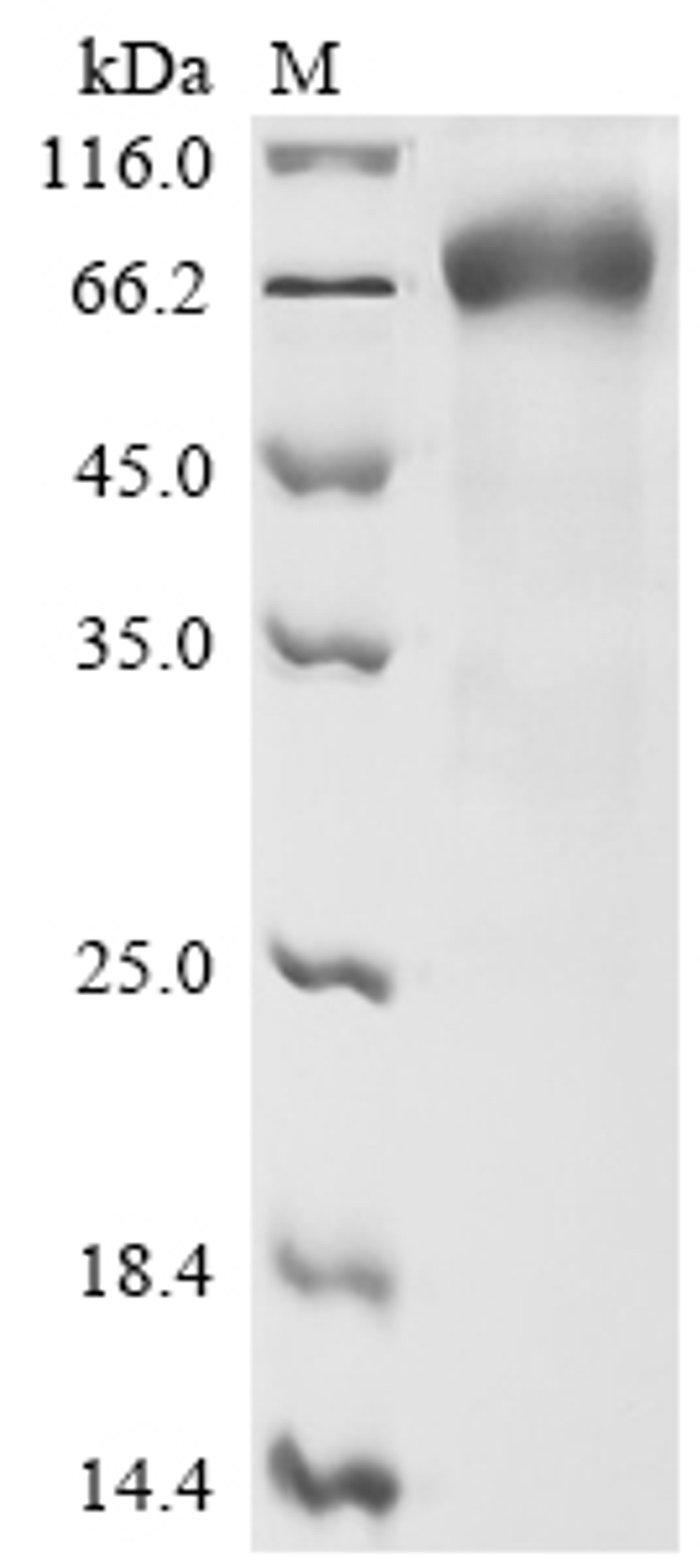 (Tris-Glycine gel) Discontinuous SDS-PAGE (reduced) with 5% enrichment gel and 15% separation gel.