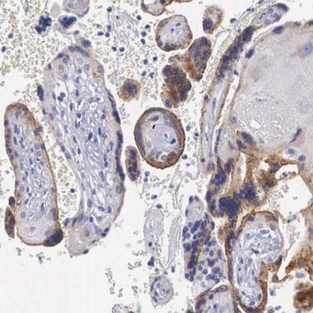 Immunohistochemistry: CRIM1 Antibody [NBP1-80799] - Human placenta showing moderate cytoplasmic and membranous positivity in trophoblastic cells.