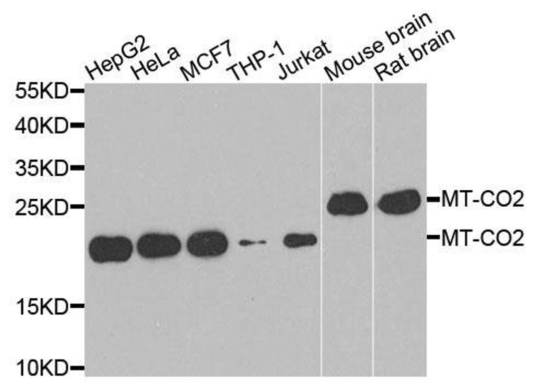 Western blot analysis of extracts of various cells using MT-CO2 antibody