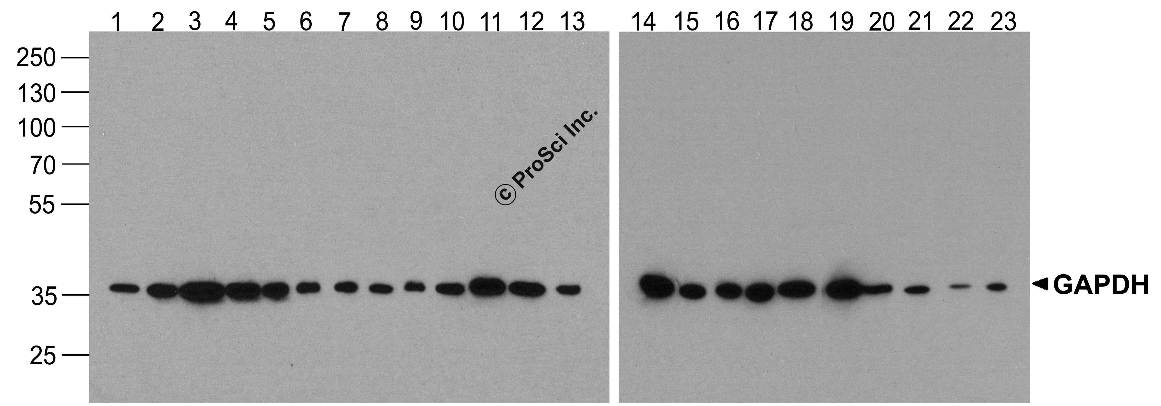 Western blot analysis of GAPDH in multiple cell and tissue lysates with GAPDH antibody at 1 μg/ml. Lanes 1-23, 293, A431, A549, Daudi, HeLa, HepG2, Jurkat, K562, MOLT, 3T3, Raji, Ramos, U937, human brain, mouse brain, rat brain, rabbit brain, human h