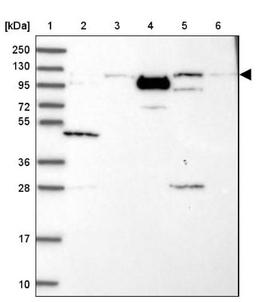 Western Blot: PHC3 Antibody [NBP1-84896] - Lane 1: Marker [kDa] 250, 130, 95, 72, 55, 36, 28, 17, 10<br/>Lane 2: Human cell line RT-4<br/>Lane 3: Human cell line U-251MG sp<br/>Lane 4: Human plasma (IgG/HSA depleted)<br/>Lane 5: Human liver tissue<br/>Lane 6: Human tonsil tissue