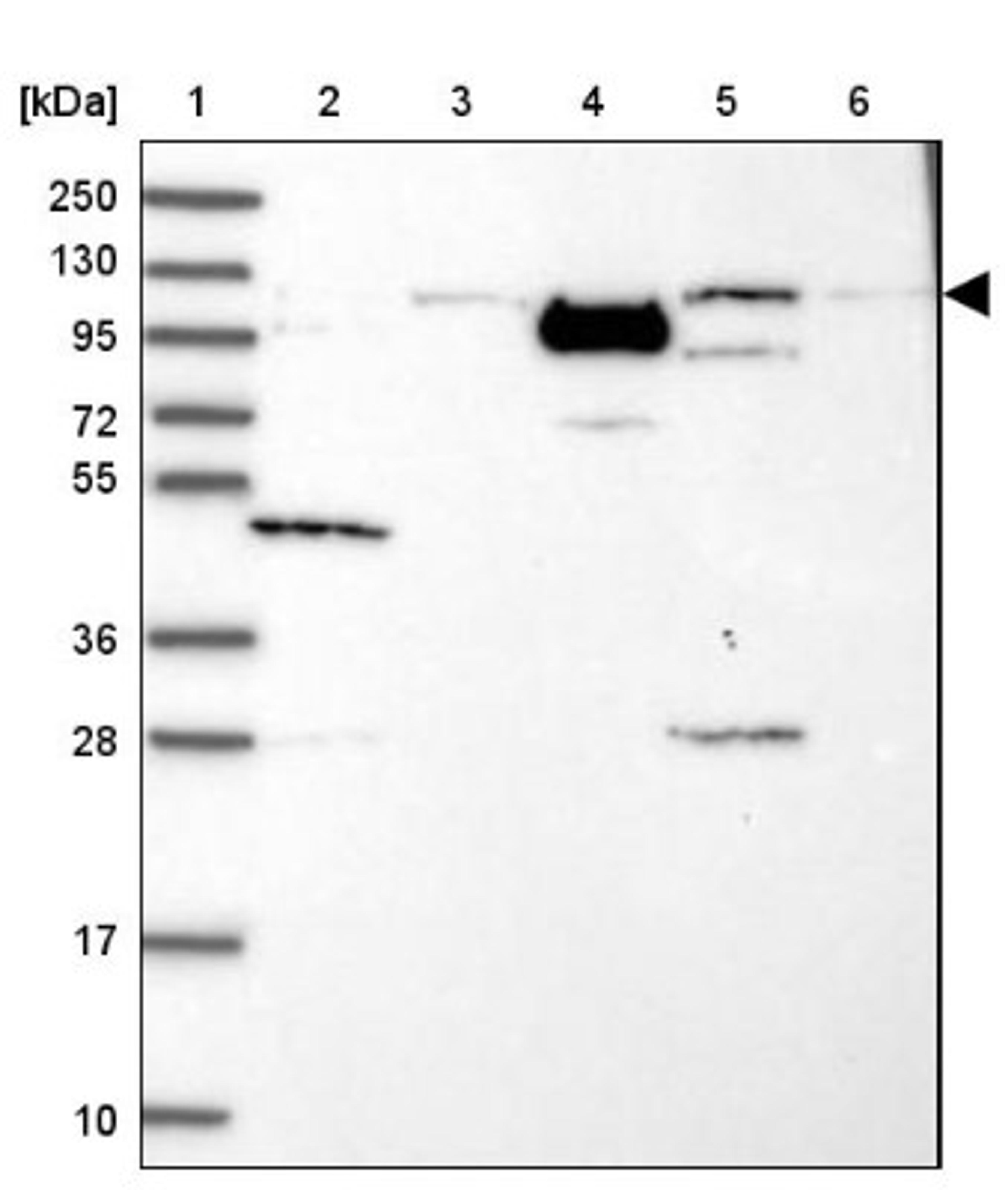 Western Blot: PHC3 Antibody [NBP1-84896] - Lane 1: Marker [kDa] 250, 130, 95, 72, 55, 36, 28, 17, 10<br/>Lane 2: Human cell line RT-4<br/>Lane 3: Human cell line U-251MG sp<br/>Lane 4: Human plasma (IgG/HSA depleted)<br/>Lane 5: Human liver tissue<br/>Lane 6: Human tonsil tissue