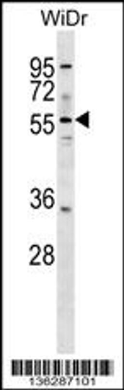 Western blot analysis in WiDr cell line lysates (35ug/lane).