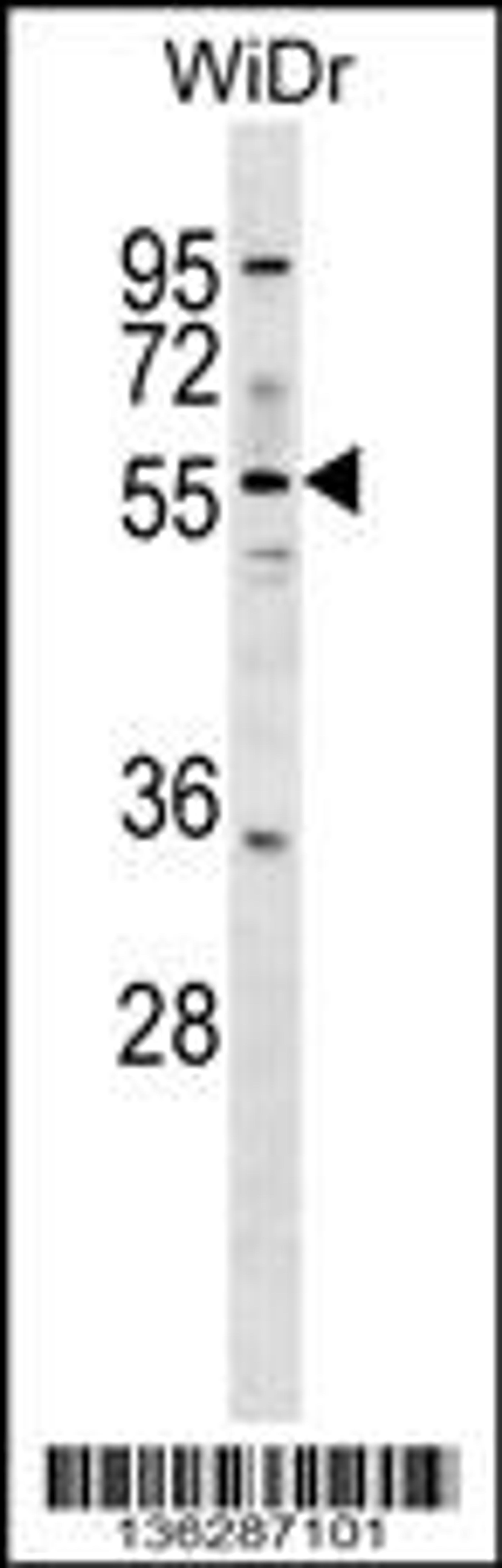 Western blot analysis in WiDr cell line lysates (35ug/lane).