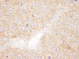 Detection of mouse SNX1 by immunohistochemistry.