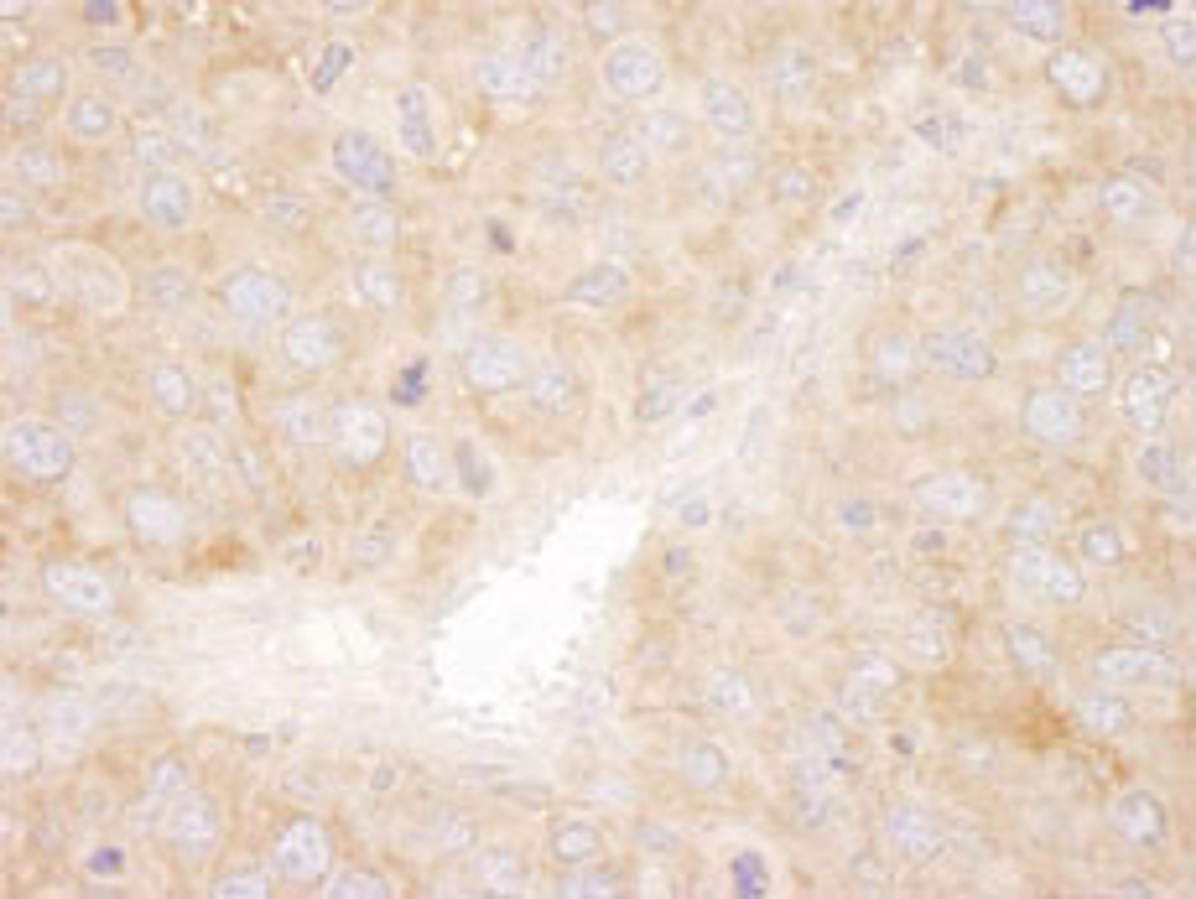 Detection of mouse SNX1 by immunohistochemistry.