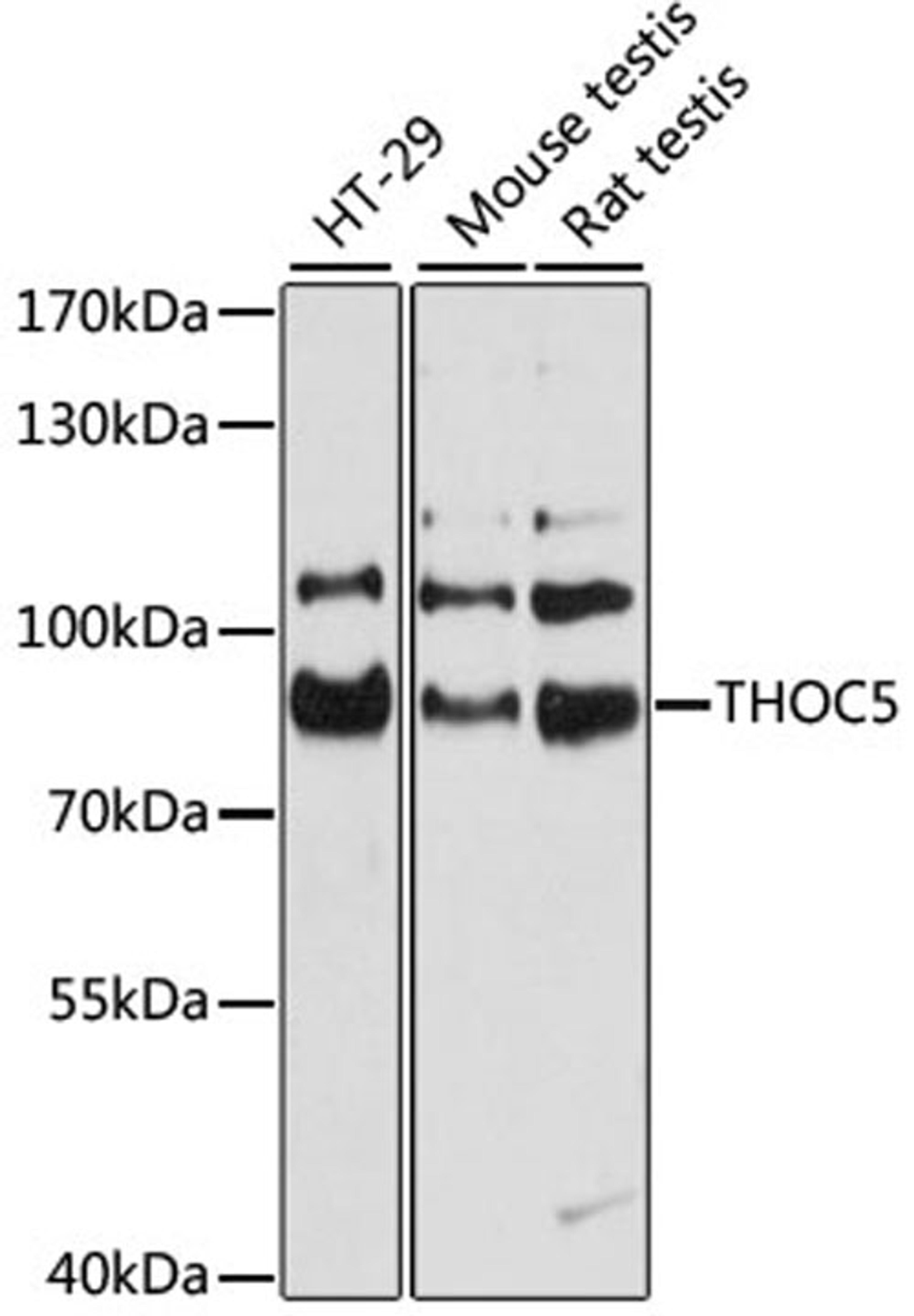 Western blot - THOC5 antibody (A11635)