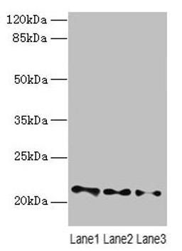 Western blot. All lanes: VPS25 antibody at 3µg/ml. Lane 1: Mouse kidney tissue. Lane 2: HL60 whole cell lysate. Lane 3: THP-1 whole cell lysate. Secondary. Goat polyclonal to rabbit IgG at 1/10000 dilution. Predicted band size: 21 kDa. Observed band size: 21 kDa