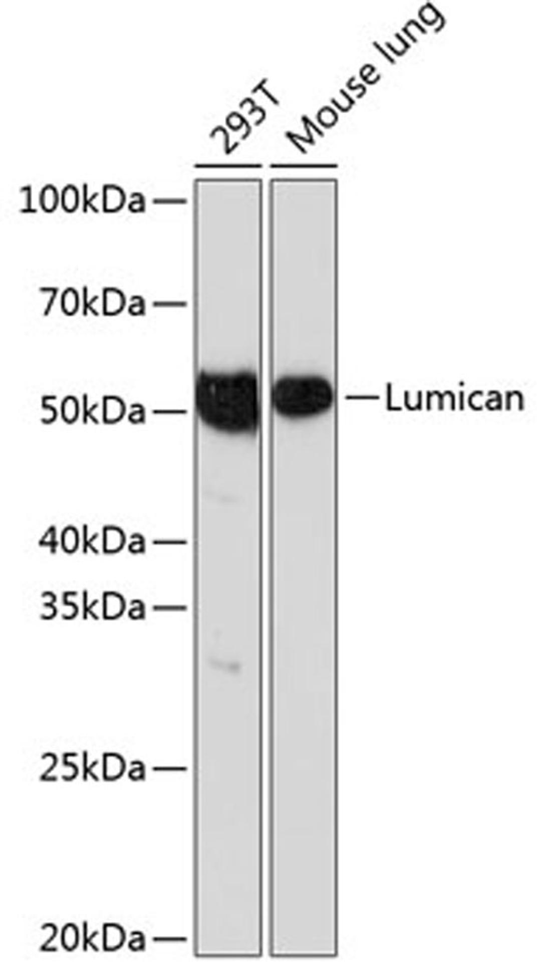 Western blot - Lumican Rabbit mAb (A11593)