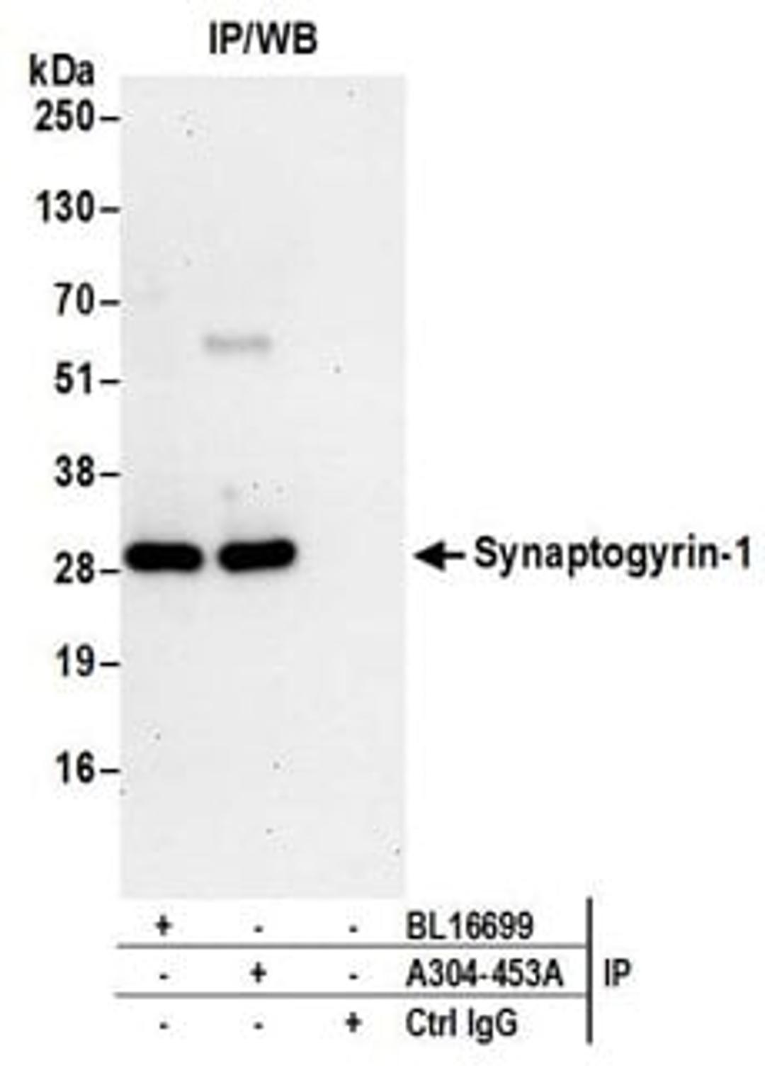 Detection of human Synaptogyrin-1 by western blot of immunoprecipitates.