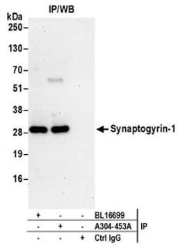 Detection of human Synaptogyrin-1 by western blot of immunoprecipitates.