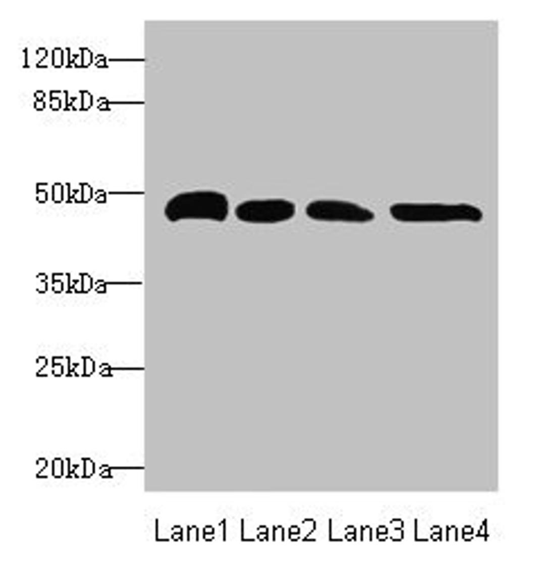Western blot. All lanes: TXNDC5 antibody at 5.75µg/ml. Lane 1: HepG2 whole cell lysate. Lane 2: Colo320 whole cell lysate. Lane 3: Mouse brain tissue. Lane 4: Mouse stomach tissue. Secondary. Goat polyclonal to rabbit IgG at 1/10000 dilution. Predicted band size: 48, 37 kDa. Observed band size: 48 kDa