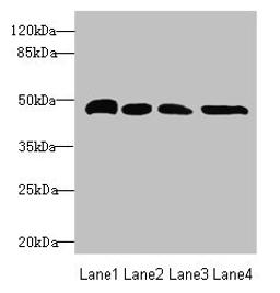 Western blot. All lanes: TXNDC5 antibody at 5.75µg/ml. Lane 1: HepG2 whole cell lysate. Lane 2: Colo320 whole cell lysate. Lane 3: Mouse brain tissue. Lane 4: Mouse stomach tissue. Secondary. Goat polyclonal to rabbit IgG at 1/10000 dilution. Predicted band size: 48, 37 kDa. Observed band size: 48 kDa