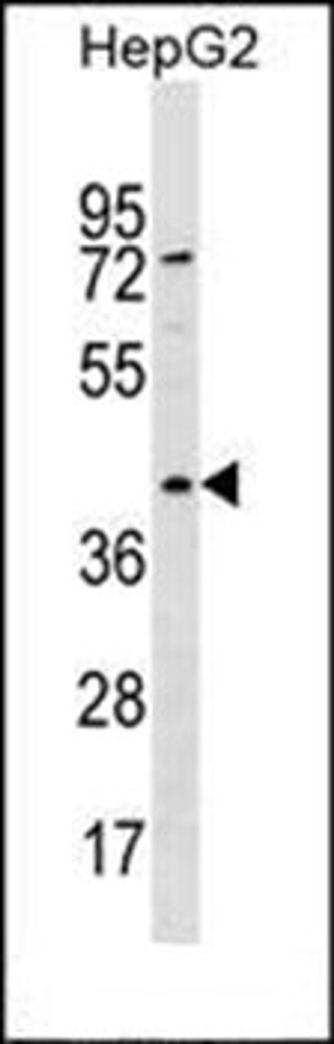 Western blot analysis of HepG2 cell line lysates (35ug/lane) using RBMXL1 antibody (Center)