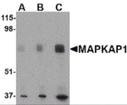 Western blot analysis of MAPKAP1 in human skeletal muscle tissue lysate with MAPKAP1 antibody at (A) 0.5, (B) 1 and (C) 2 &#956;g/mL.