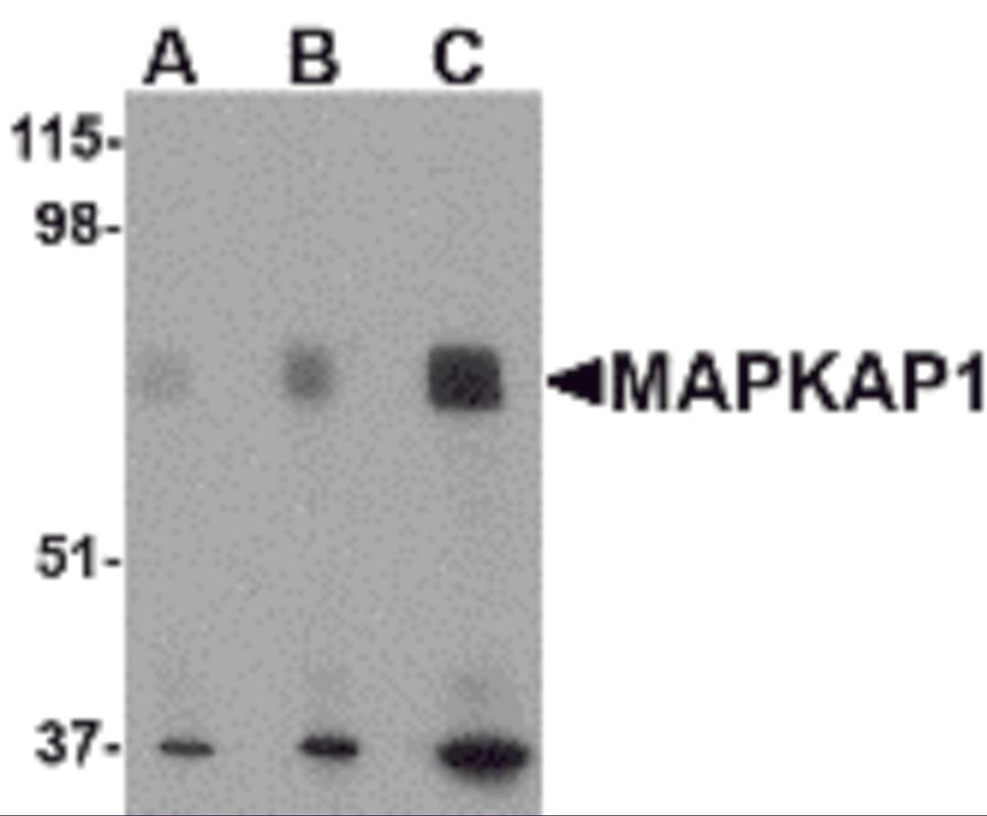 Western blot analysis of MAPKAP1 in human skeletal muscle tissue lysate with MAPKAP1 antibody at (A) 0.5, (B) 1 and (C) 2 μg/mL.