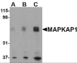 Western blot analysis of MAPKAP1 in human skeletal muscle tissue lysate with MAPKAP1 antibody at (A) 0.5, (B) 1 and (C) 2 μg/mL.