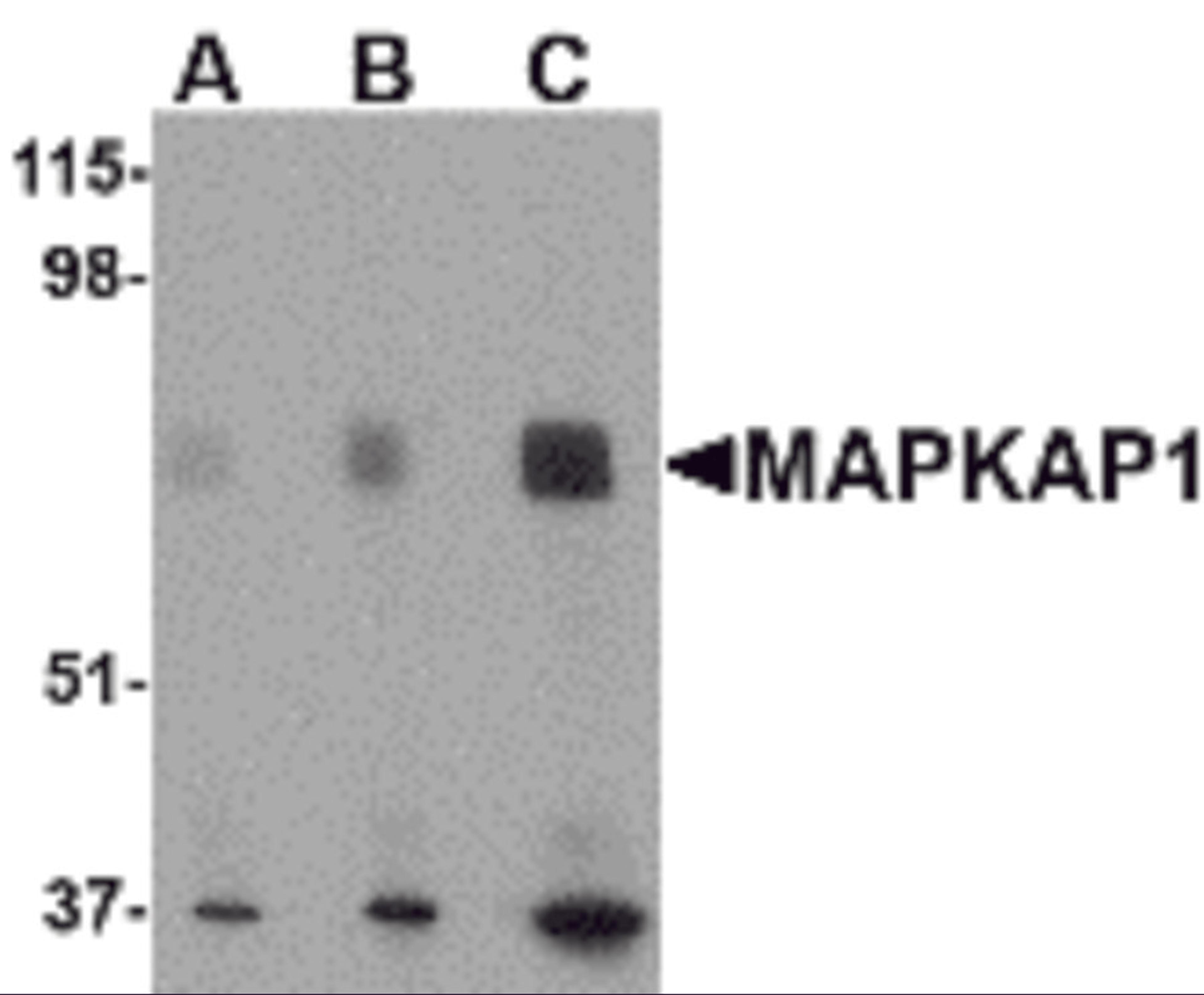 Western blot analysis of MAPKAP1 in human skeletal muscle tissue lysate with MAPKAP1 antibody at (A) 0.5, (B) 1 and (C) 2 μg/mL.