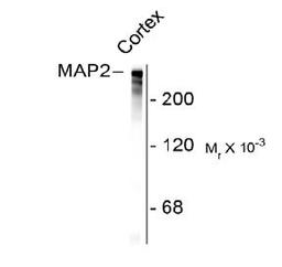 Western blot of rat cortex lysate showing specific immunolabeling of the ~280k MAP2 protein. <br><br> <b>Below:</b> Mixed neuron/glial cultures. The perikarya and dendrites of neurons are strongly and specifically stained with the MAP2 antibody (red). Cel