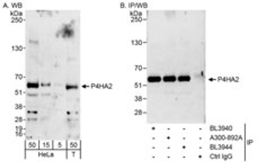 Detection of human P4HA2 by western blot and immunoprecipitation.