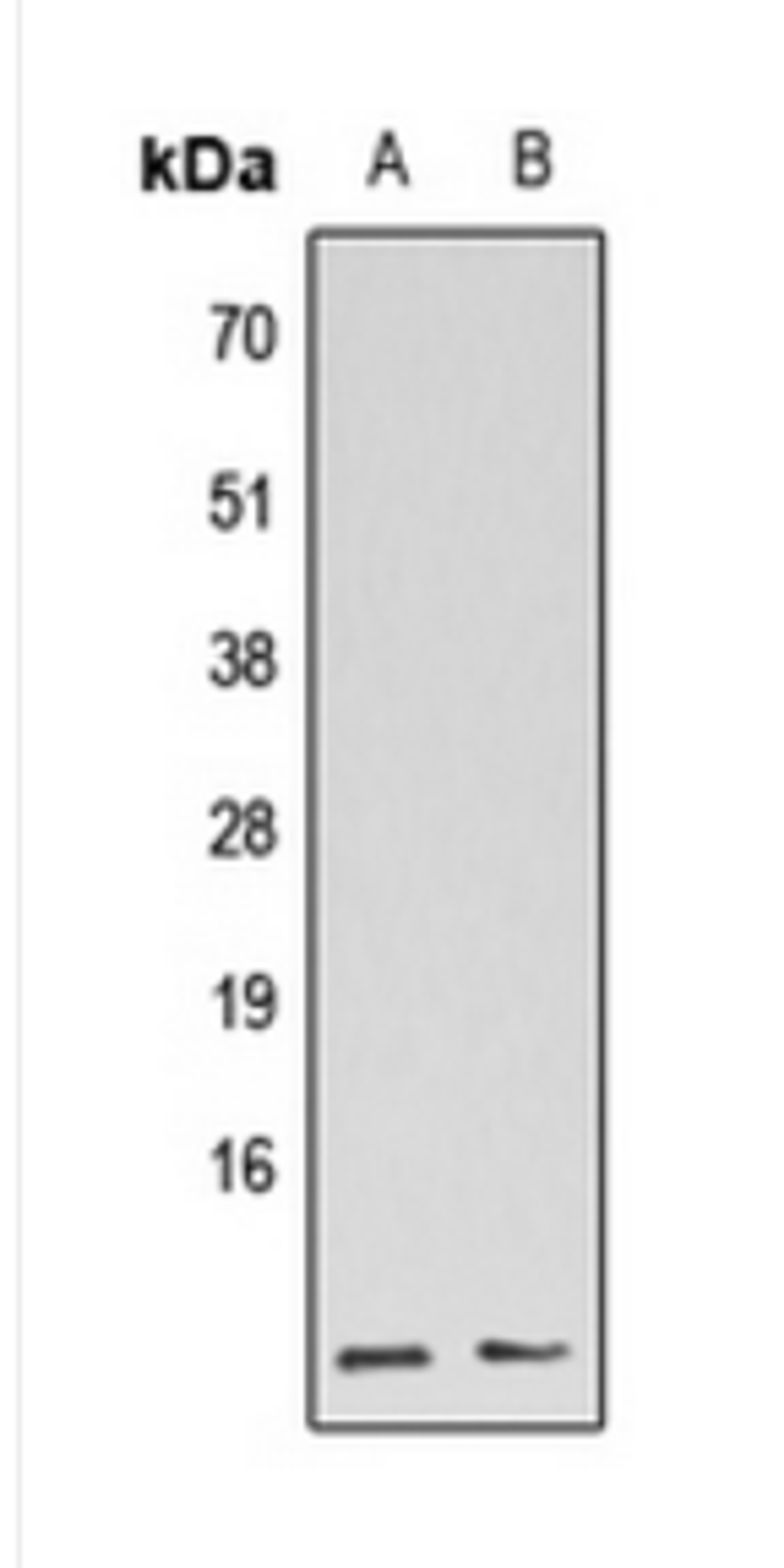 Western blot analysis of HEK293T (Lane 1), Raw264.7 (Lane 2) whole cell lysates using GBG5L antibody