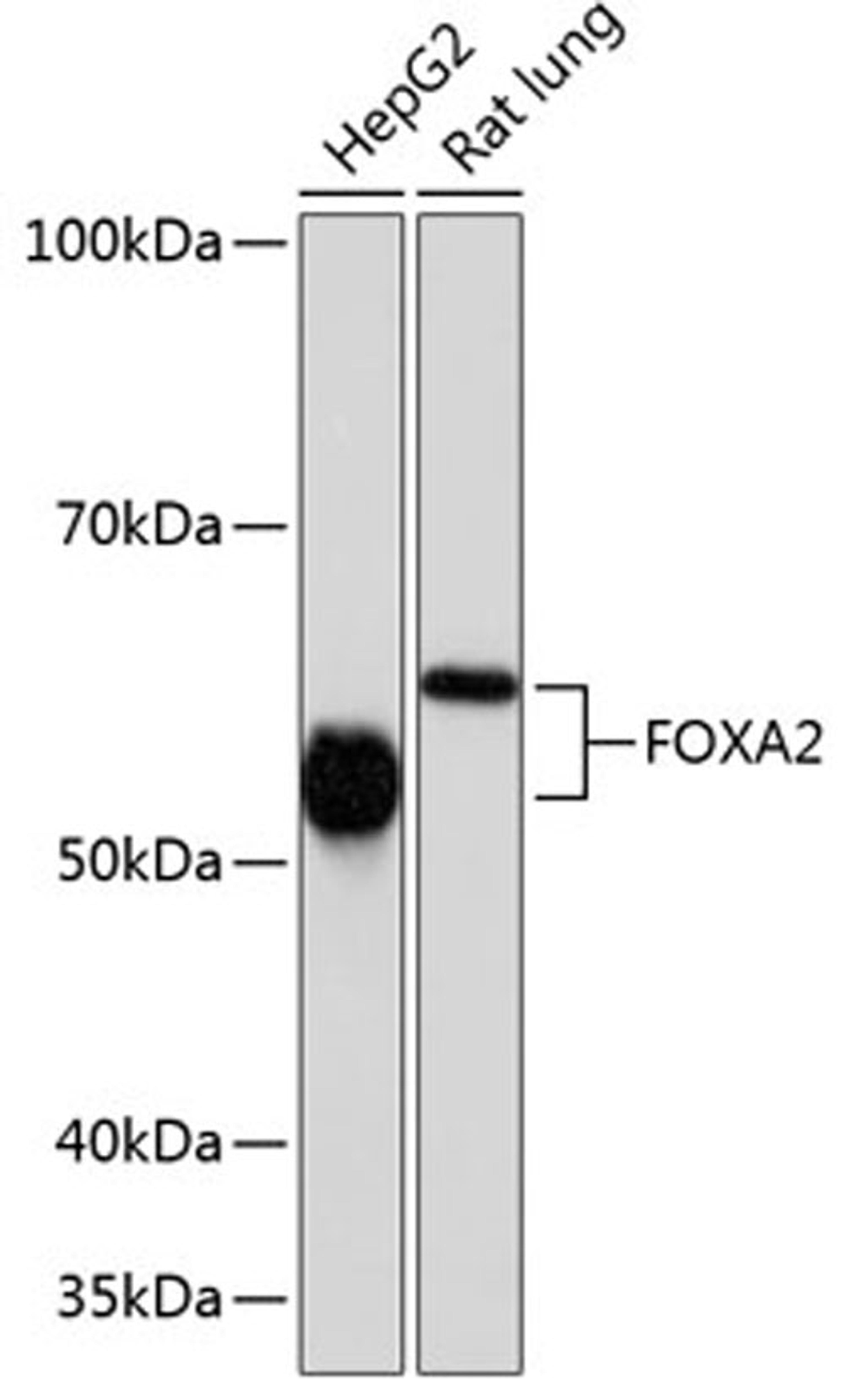 Western blot - FOXA2 antibody (A19053)