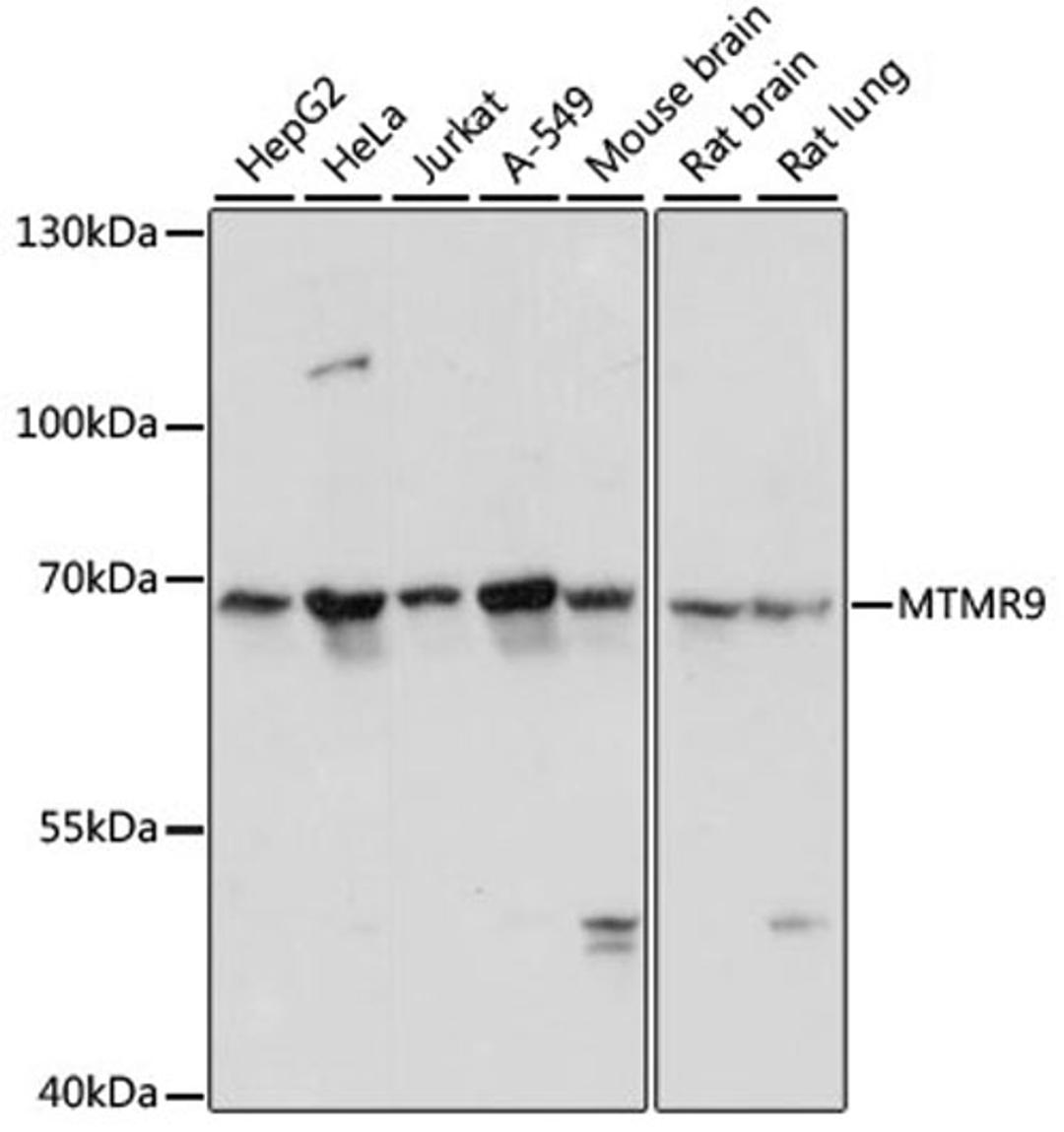 Western blot - MTMR9 antibody (A13124)