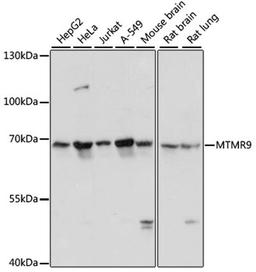 Western blot - MTMR9 antibody (A13124)