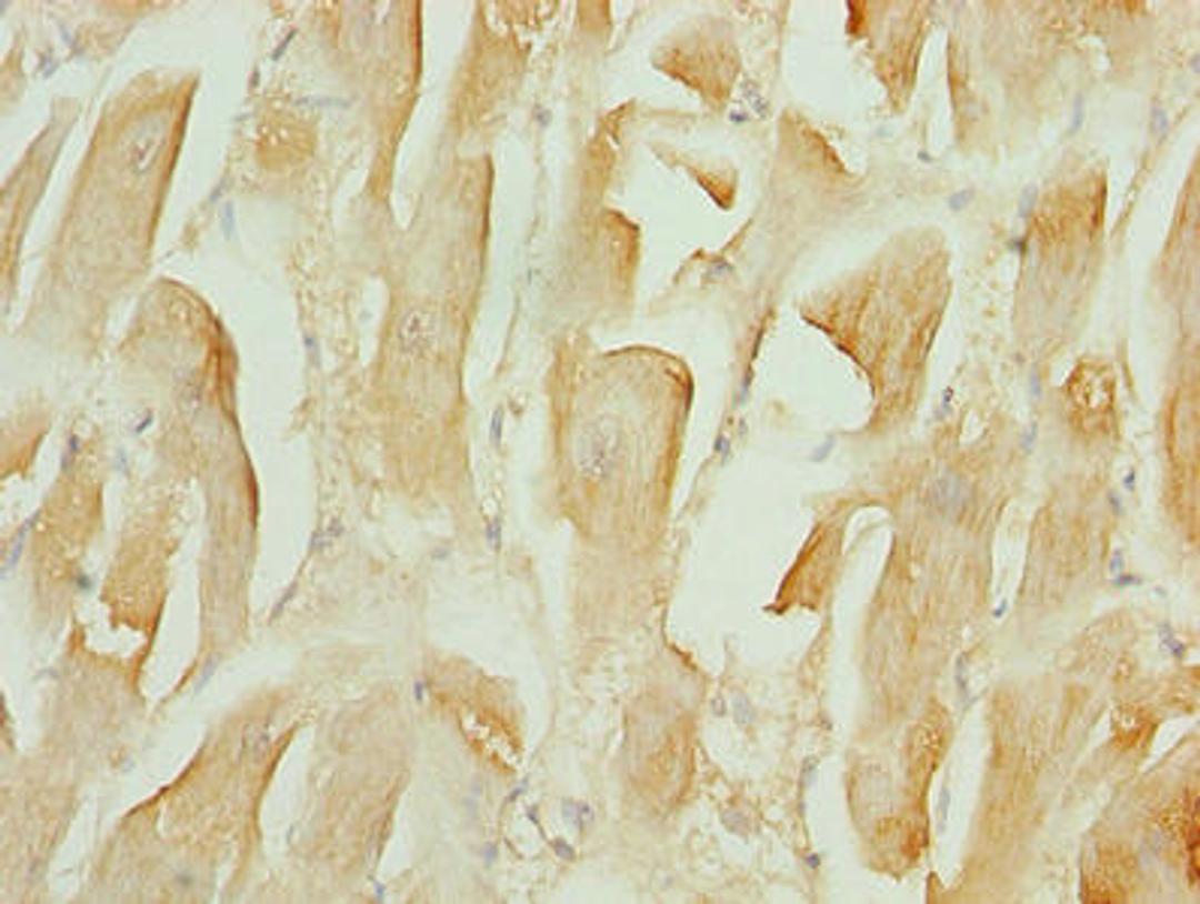 Immunohistochemistry of paraffin-embedded human heart tissue using CSB-PA023771LA01HU at dilution of 1:100