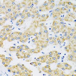 Immunohistochemistry  - SLC16A4 antibody (A14818)