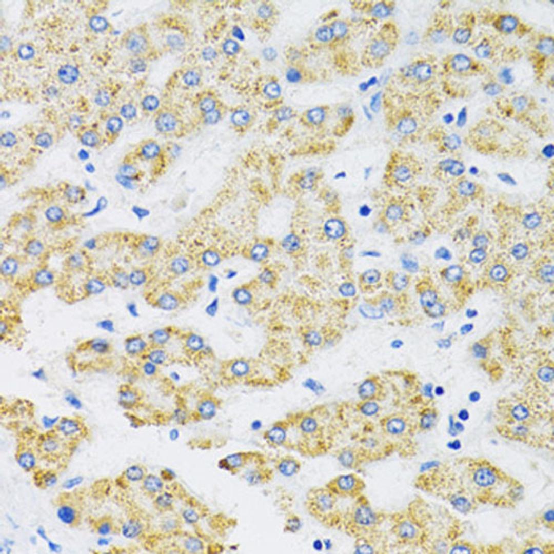 Immunohistochemistry - SLC16A4 antibody (A14818)