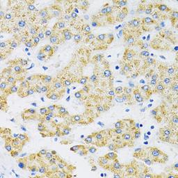 Immunohistochemistry - SLC16A4 antibody (A14818)