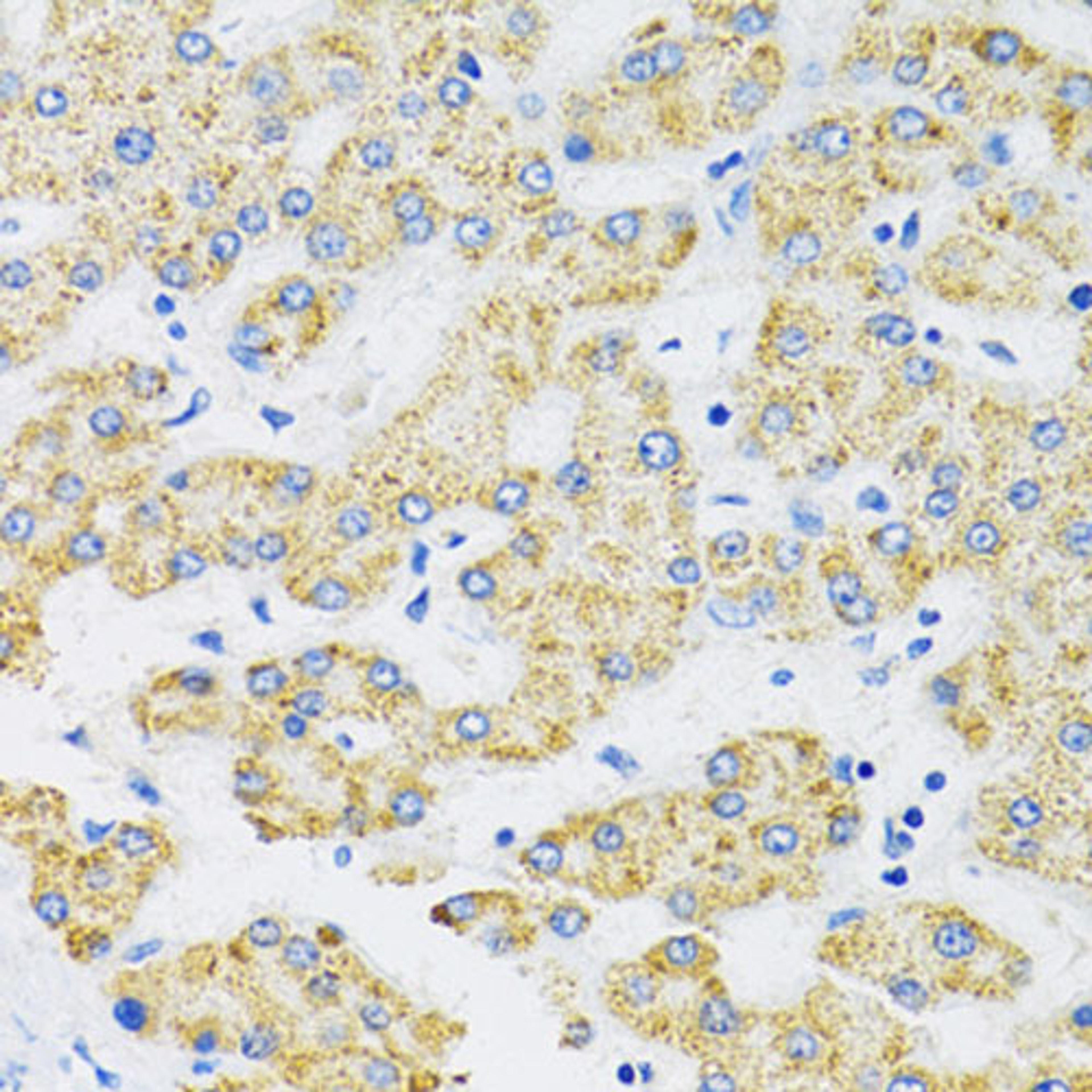 Immunohistochemistry - SLC16A4 antibody (A14818)