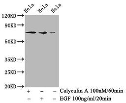 Western Blot. Positive WB detected in Hela whole cell lysate(treated with Calyculin A or EGF). All lanes Phospho-RAF1 antibody at 1.18μg/ml. Secondary. Goat polyclonal to rabbit IgG at 1/50000 dilution. Predicted band size: 73 KDa. Observed band size: 73 KDa.