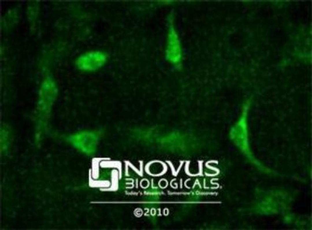 Immunocytochemistry/Immunofluorescence: Kos1/Tnk1 Antibody [NB300-237] - Kos1 staining in Hela cells detected with a Dylight 488 labeled secondary antibody.