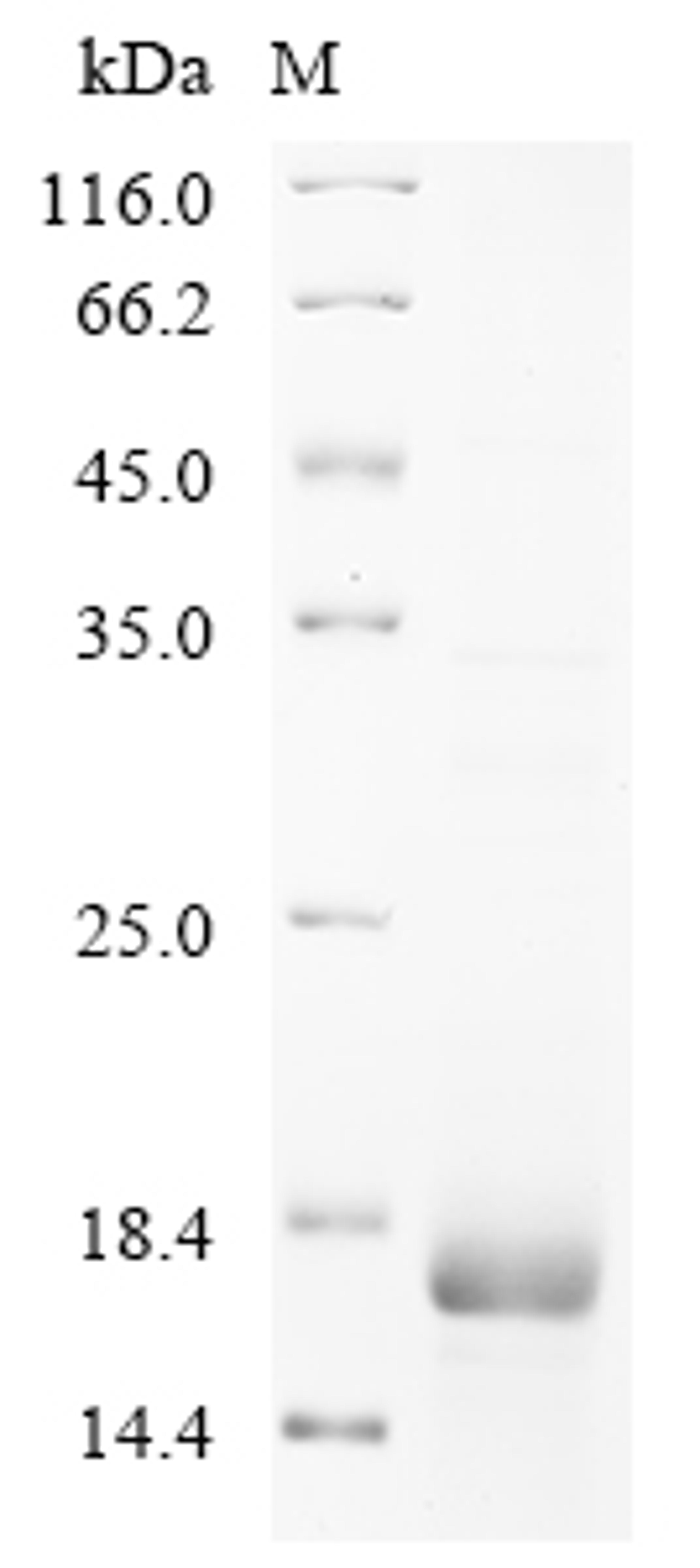 (Tris-Glycine gel) Discontinuous SDS-PAGE (reduced) with 5% enrichment gel and 15% separation gel.