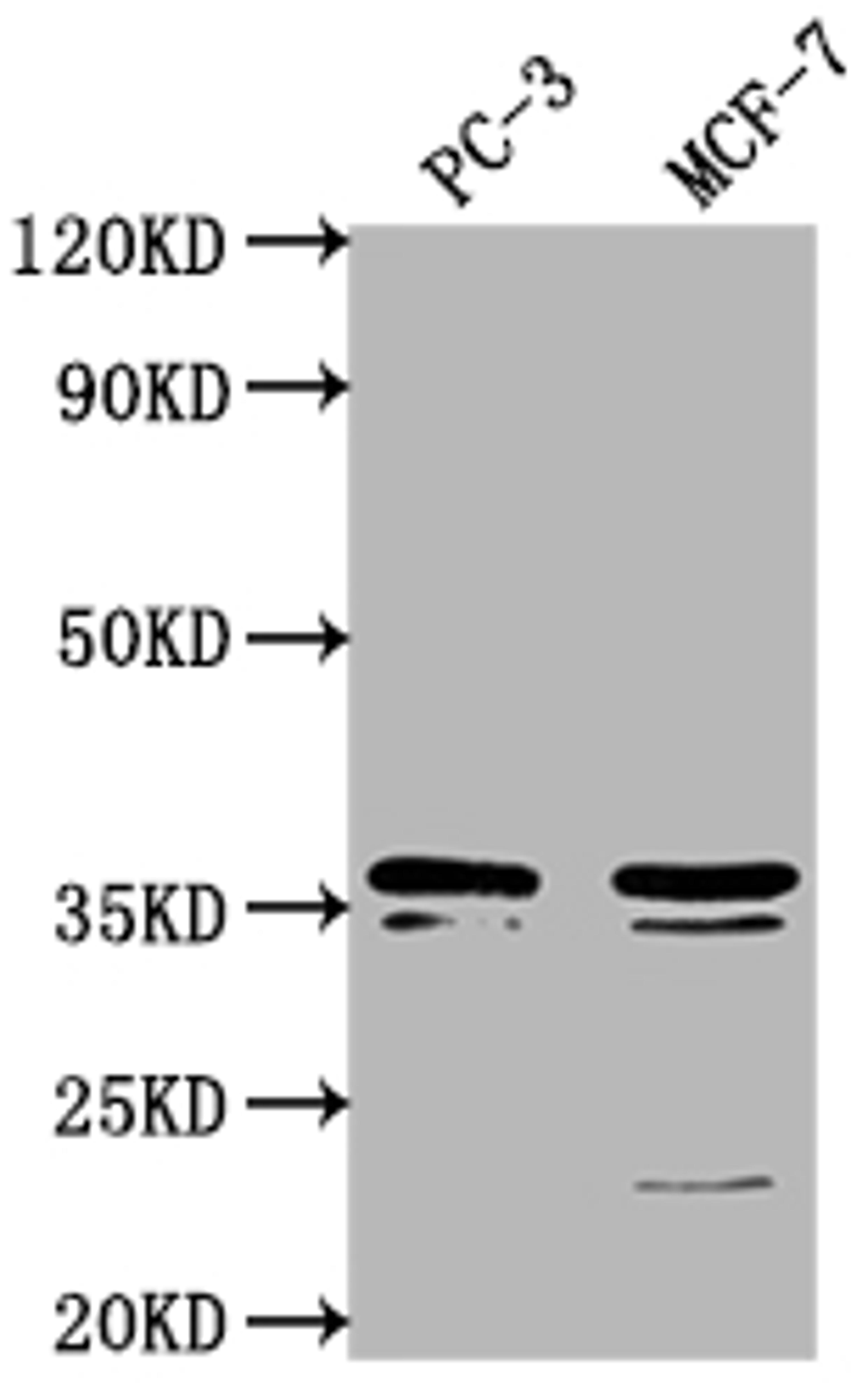 Western Blot. Positive WB detected in: PC-3 whole cell lysate, MCF-7 whole cell lysate. All lanes: OR6C1 antibody at 1:1000. Secondary. Goat polyclonal to rabbit IgG at 1/50000 dilution. Predicted band size: 36 kDa. Observed band size: 36 kDa.