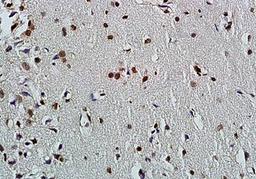 Immunohistochemical analysis of paraffin embedded rat brain tissue using FOXC1 antibody