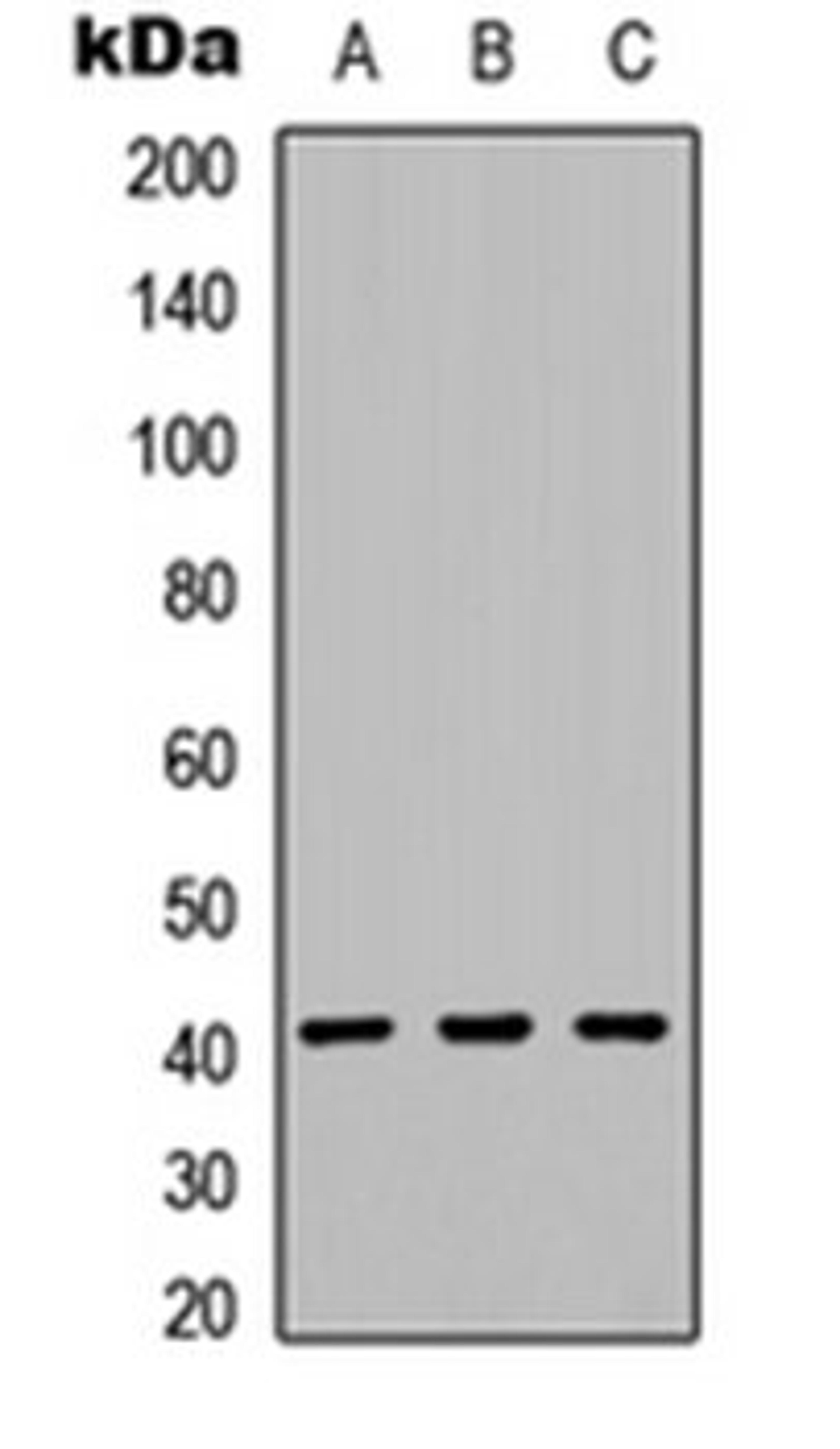 Western blot analysis of HEK293T (Lane 1), NS-1 (Lane 2), PC12 (Lane 3) whole cell lysates using CD158f1 antibody