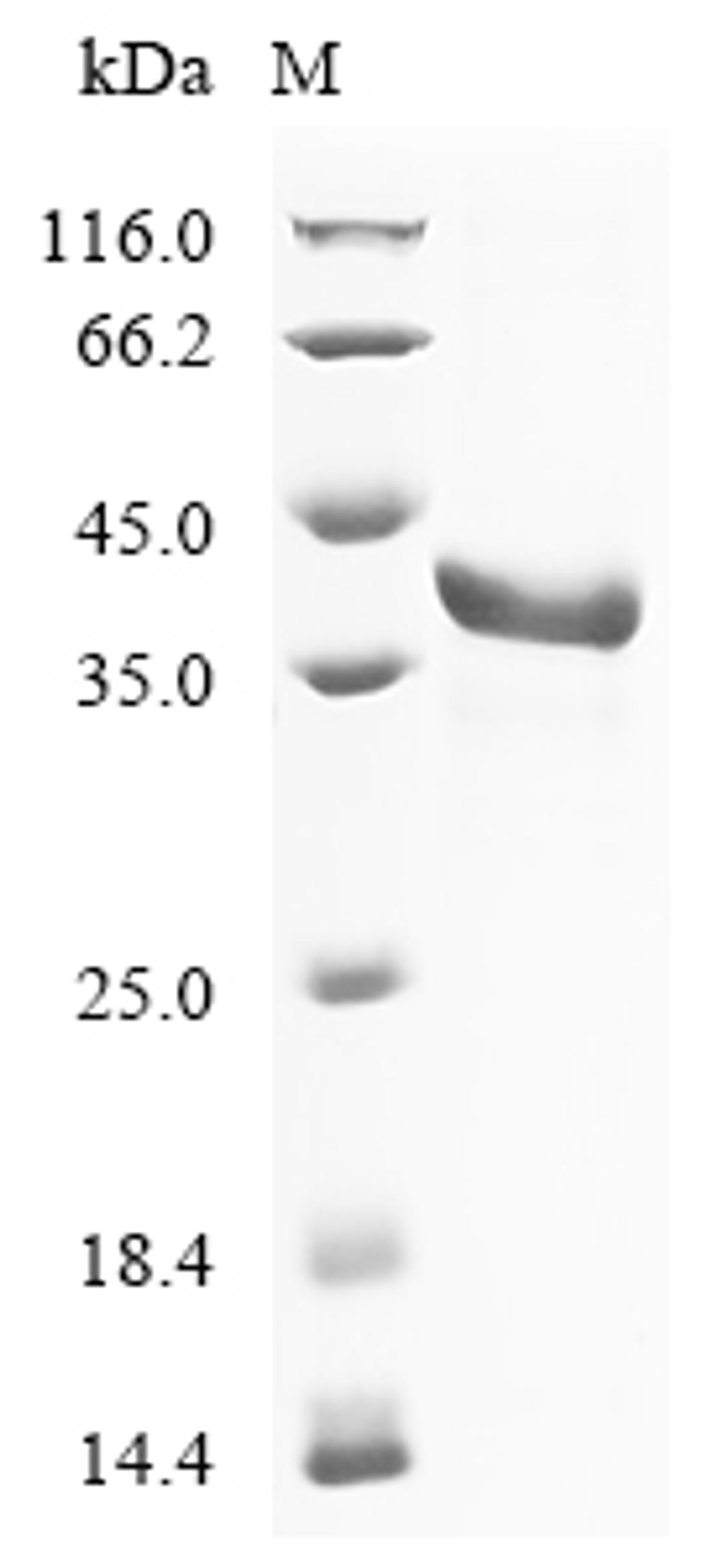 (Tris-Glycine gel) Discontinuous SDS-PAGE (reduced) with 5% enrichment gel and 15% separation gel.